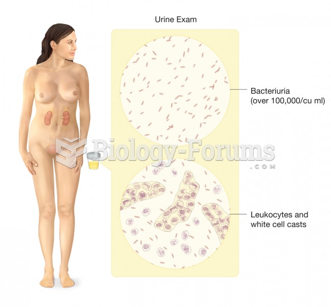 Urinary tract infection. A UTI is characterized by fever, lumbar or abdominal pain, and pain or burn