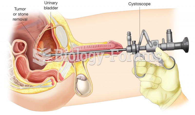 Cystoscopy. In this procedure, a specialized endoscope with a rigid tube, known as a cystoscope, is 