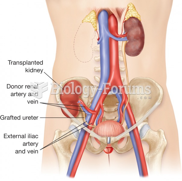 Renal transplant. A transplanted kidney is placed within the pelvic cavity below the location of the