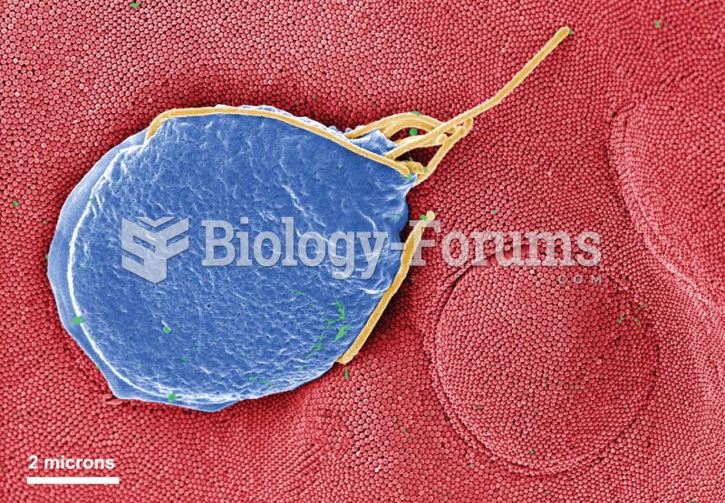 Giardiasis. Colorized electron micrograph of a Giardia protozoan adhering to the surface of an epith