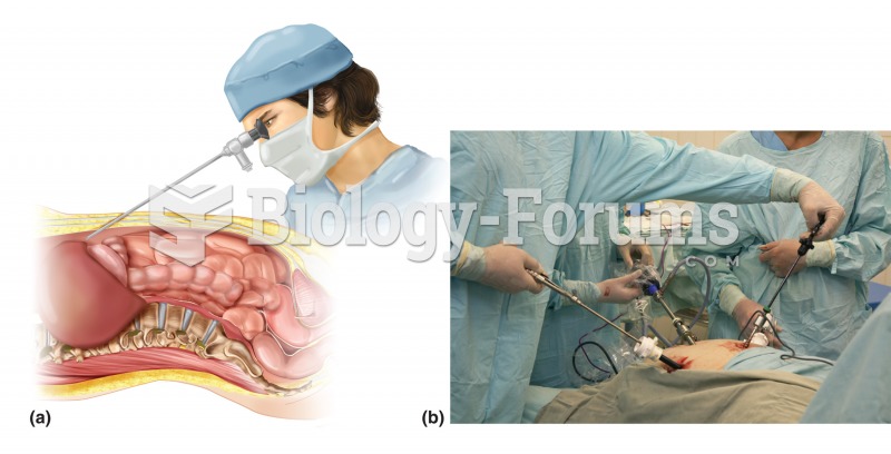 GI endoscopy. (a) Similar to other forms of GI endoscopy, laparoscopy involves the insertion of a sp