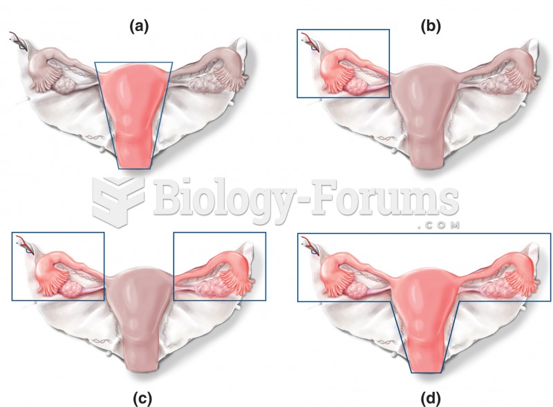 Alternative forms of surgeries involving the uterus, ovaries, and fallopian tubes. The solid lines i
