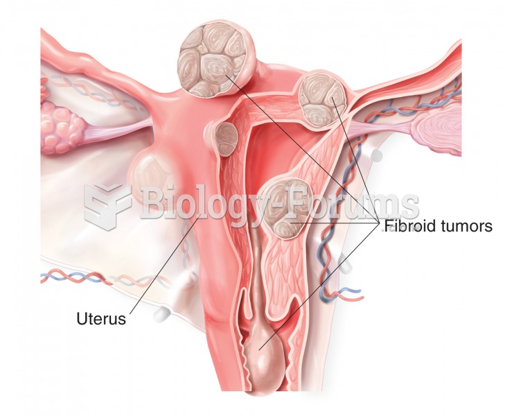 Fibroid tumors, or leiomyomas. Fibroids develop from the uterus to form a variety of hard, round ben