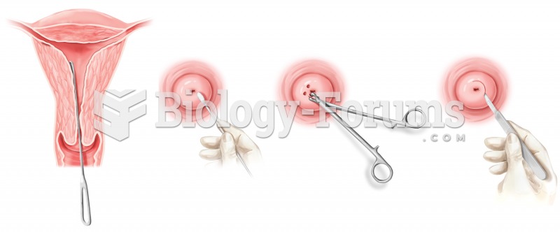 Biopsy. Various forms of gynecological biopsy are shown.