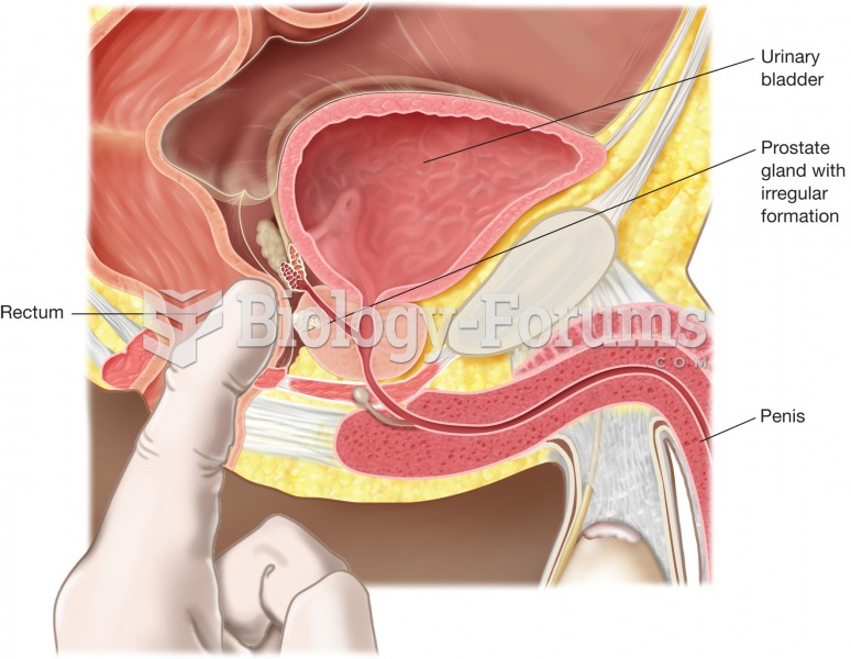 Digital rectal exam (DRE). The physician’s index finger is inserted into the rectum and pressed agai