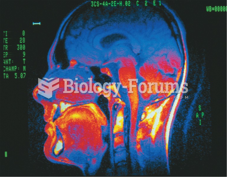 Color-enhanced magnetic resonance image (MRI) showing a sagittal view of the head. 