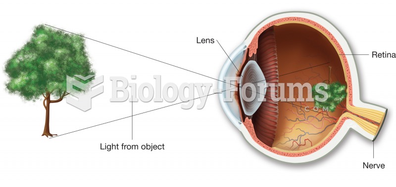 The image formed on the retina is inverted. The brain rights the image as part of the interpretation