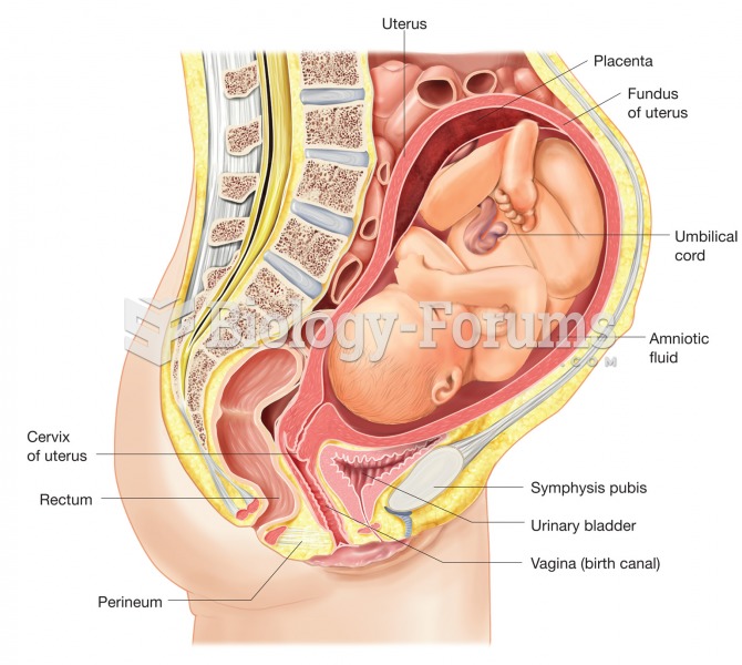 A full-term pregnancy. Image illustrates position of the fetus and the structures associated with pr