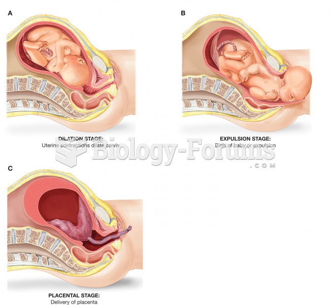 The stages of labor and delivery. (A) During the dilation stage the cervix thins and dilates to 10 c