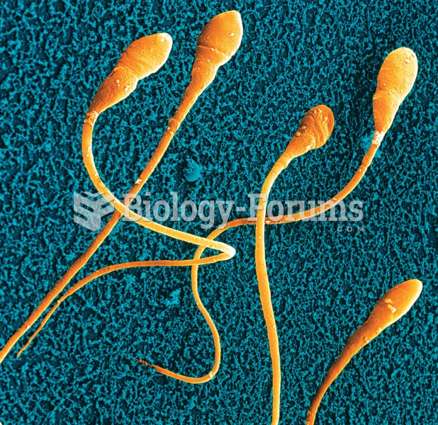 Electron-micrograph of human sperm.