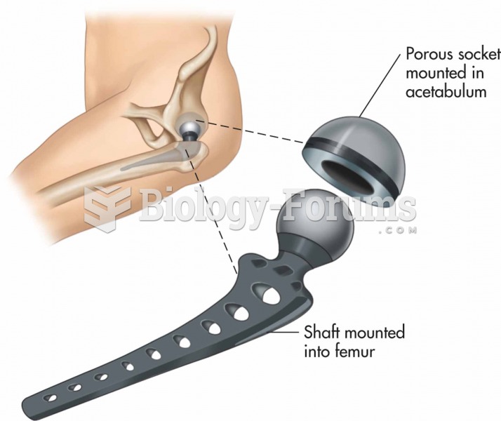 Total hip prosthesis.