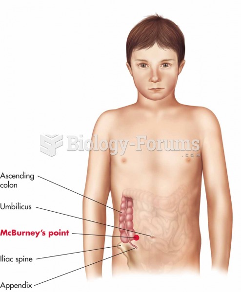 McBurney’s point is the common location of pain in children and adolescents with appendicitis.