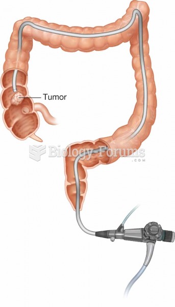Note the tumor visualized with the use of a colonoscope.