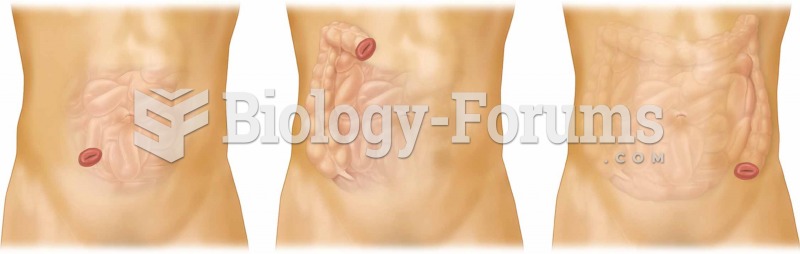 Alternate sites that can be used to create a new opening (-ostomy) in the colon.