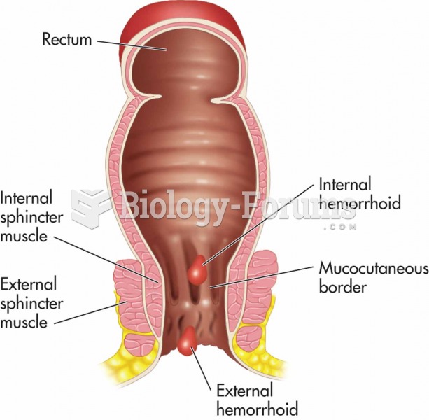 Location of internal and external hemorrhoids.