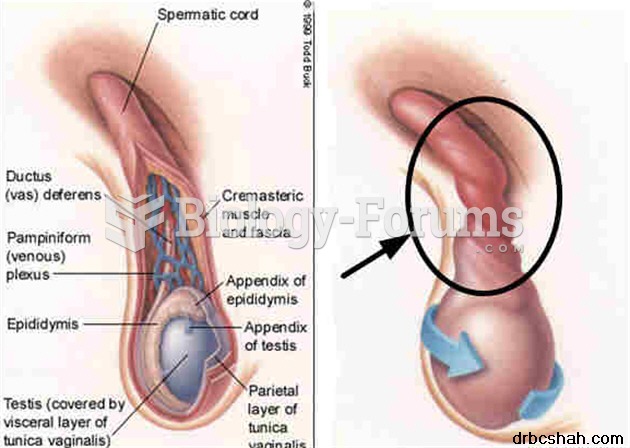 testicle fixation