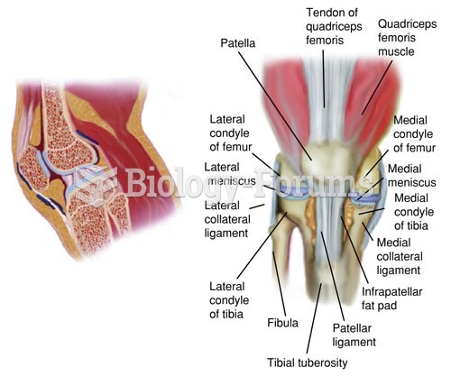 Anatomy of the Right Knee Joint, Anterior View
