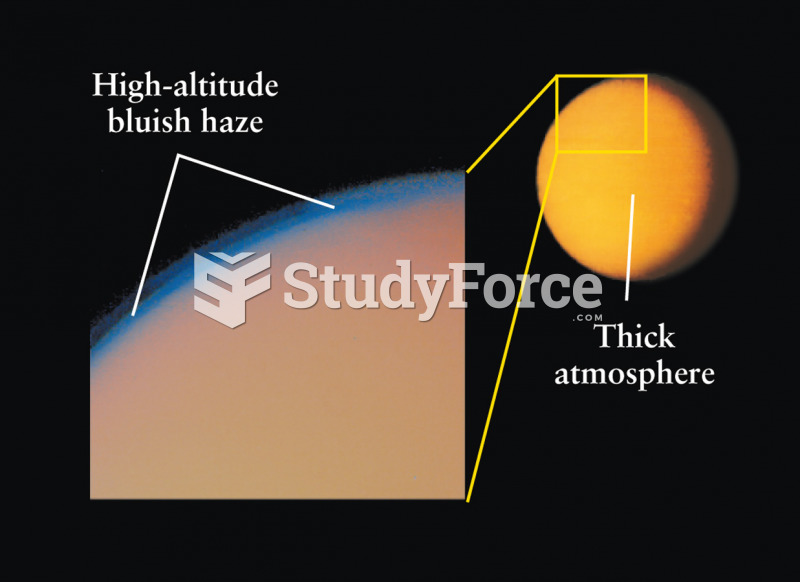 Surface Features on Titan