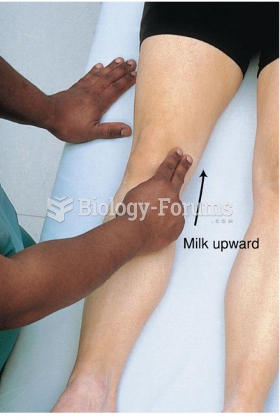 Assessing for Bulge Sign,  Milking the Patella