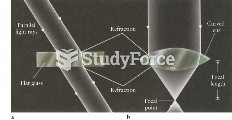 Refraction Through Uniform and Variable Thickness Glasses