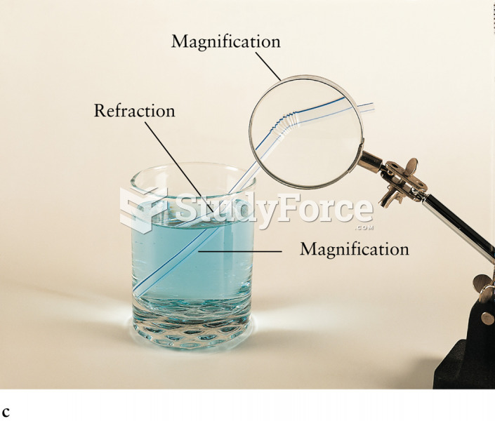 Refraction Through Uniform and Variable Thickness Glasses