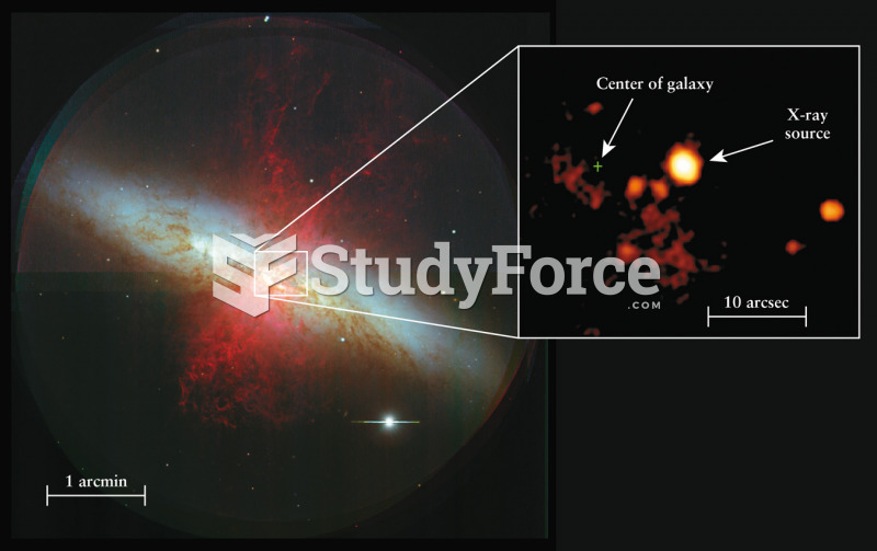 An “Intermediate-Mass” Black Hole