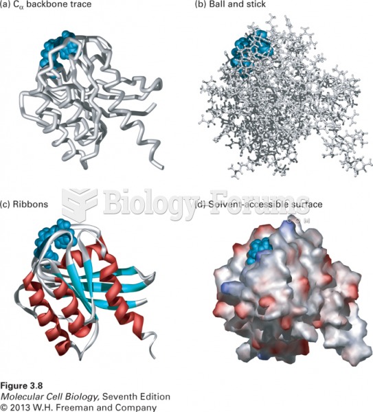 Four ways to visualize protein structure