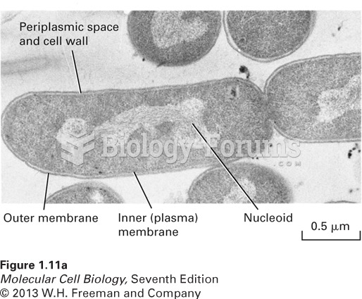 Prokaryotic cells are have a relatively simple structure