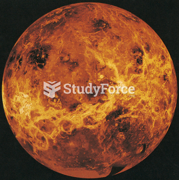 A “Global” View of Venus