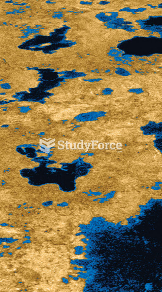 Surface Features on Titan