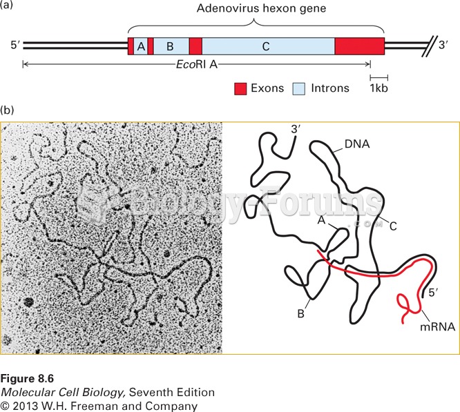 Electron microscopy of mRNA-template DNA hybrids shows that introns are spliced