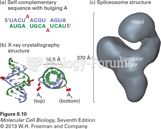 Structures of a bulged A in an RNA-RNA helix and an intermediate in the splicing