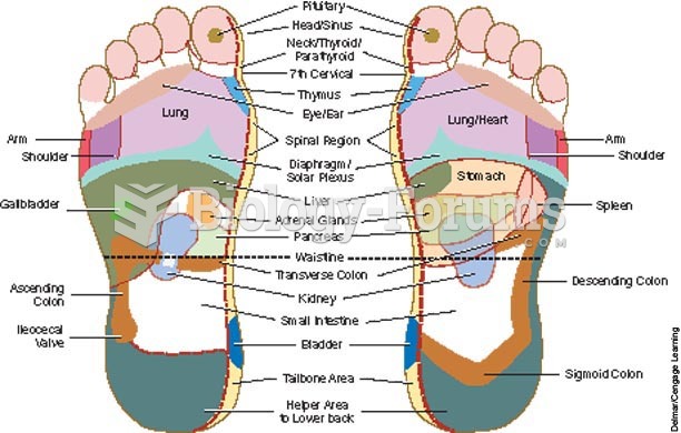 Foot reflexology chart indicates points on the foot that reflexively correspond to other areas of th