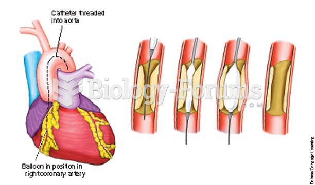 Demonstration of the function of a balloon-tipped catheter during a PTCA procedure.