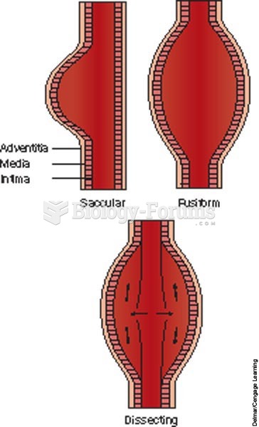 Three types of aneurysms.