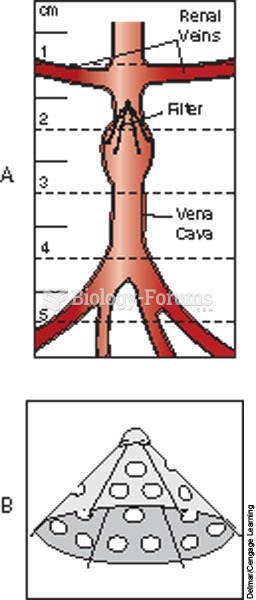 Filter in the vena cava prevents an embolus from traveling to the heart, lungs, or brain; A, Greenfi