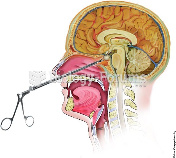 Transsphenoidal approach to hypophysectomy.