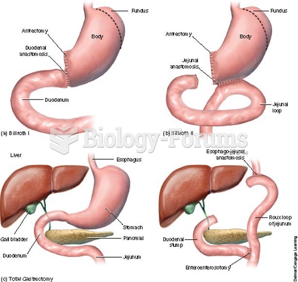 Types of gastric surgeries