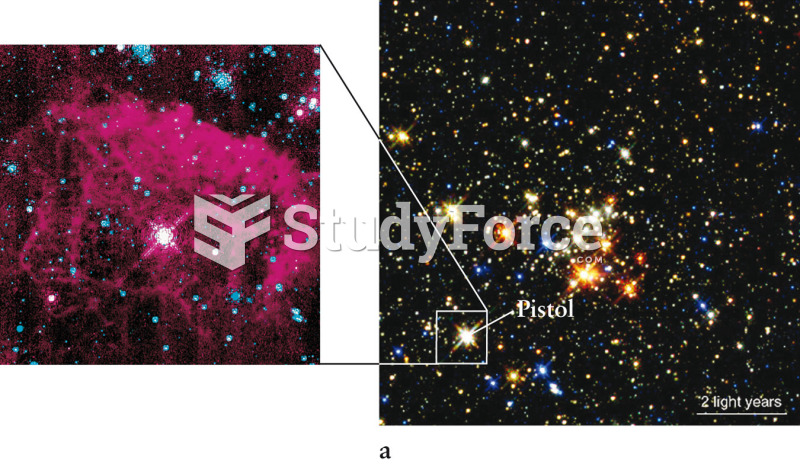 Mass Loss from a Supermassive Star