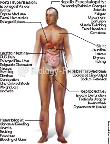 Signs and symptoms of chronic liver failure.