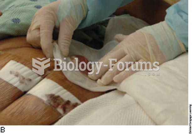 Application of an ostomy bag or pouch:  B, An ostomy nurse applying an ostomy bag to a stoma;