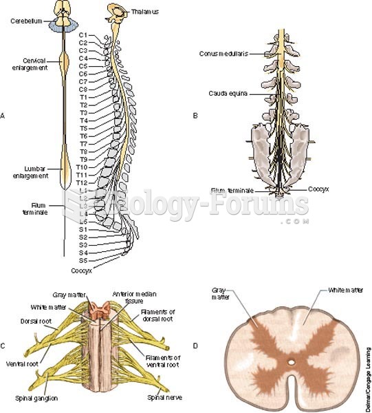 Spinal cord, spinal nerves, conus medullaris, filum terminale, anterior view of spinal cord