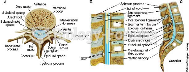 Cross-sectional anatomy of the spine
