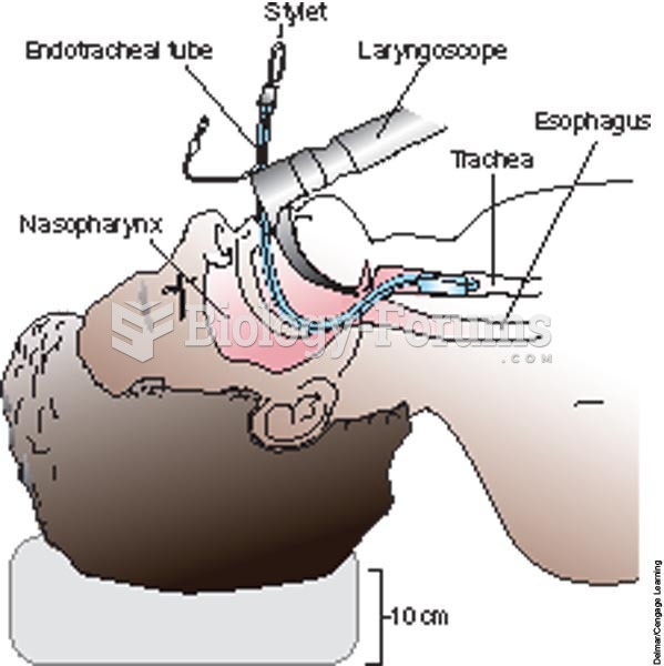 Placing an endotracheal tube in the trachea with direct visualization by laryngoscopy.