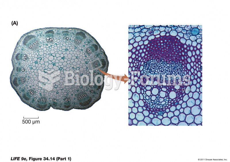 Vascular Bundles in Stems (Part 1)