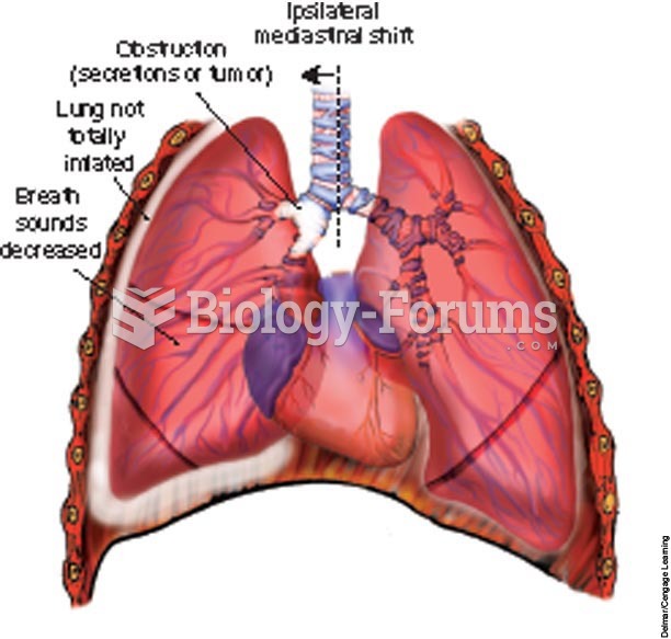 Atelectasis (collapsed lung).