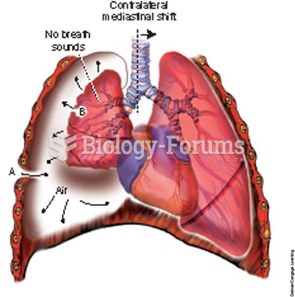 Pneumothorax; A, penetrating wound; B, ruptured bleb on the lung.