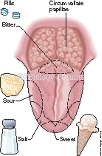 Taste regions of the tongue.