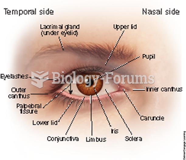 External view of the right eye.