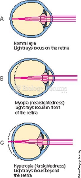 Refraction; A, normal eye; B, myopia; C, hyperopia.